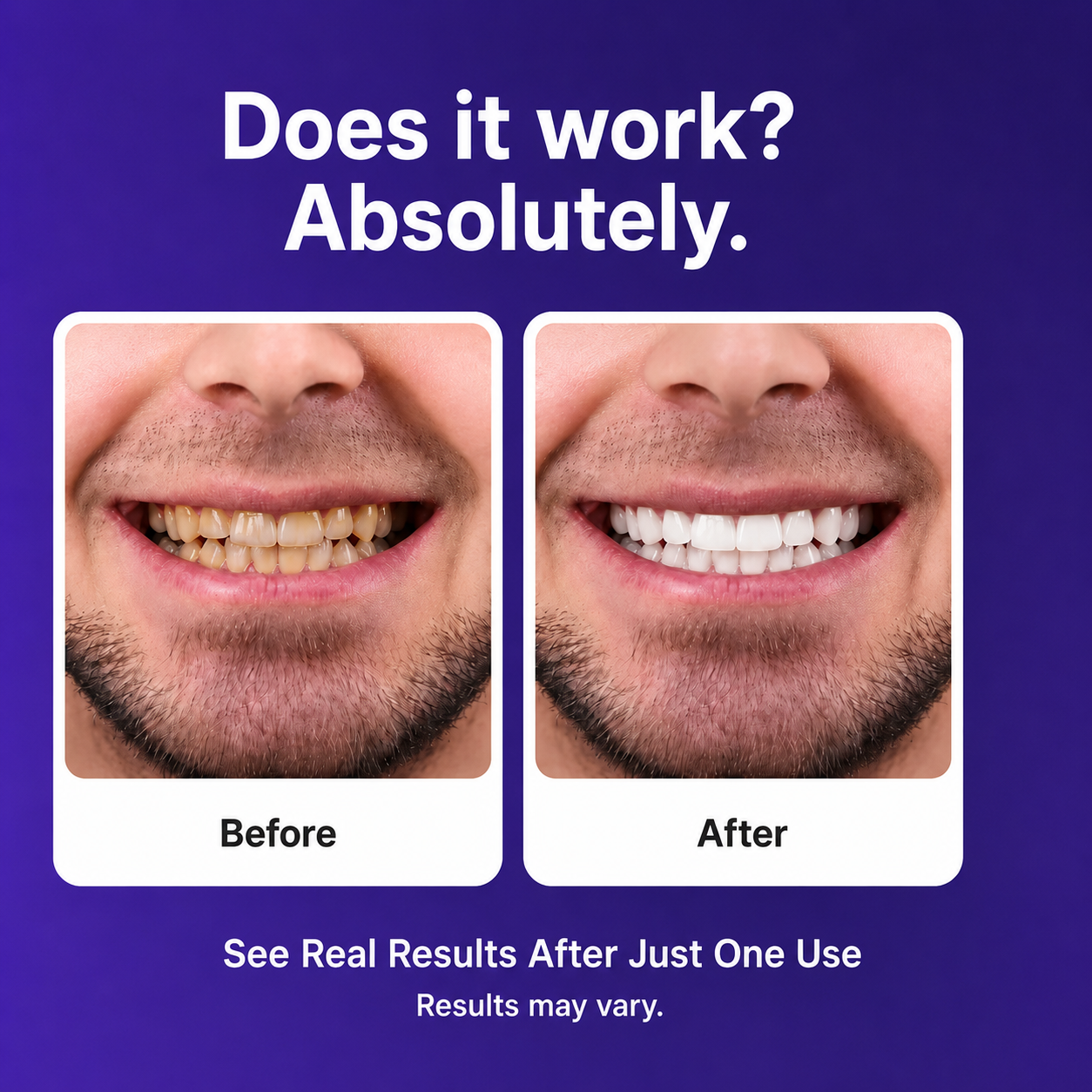 🔥 Limited-Time Deal: Purple Teeth Whitening Strips