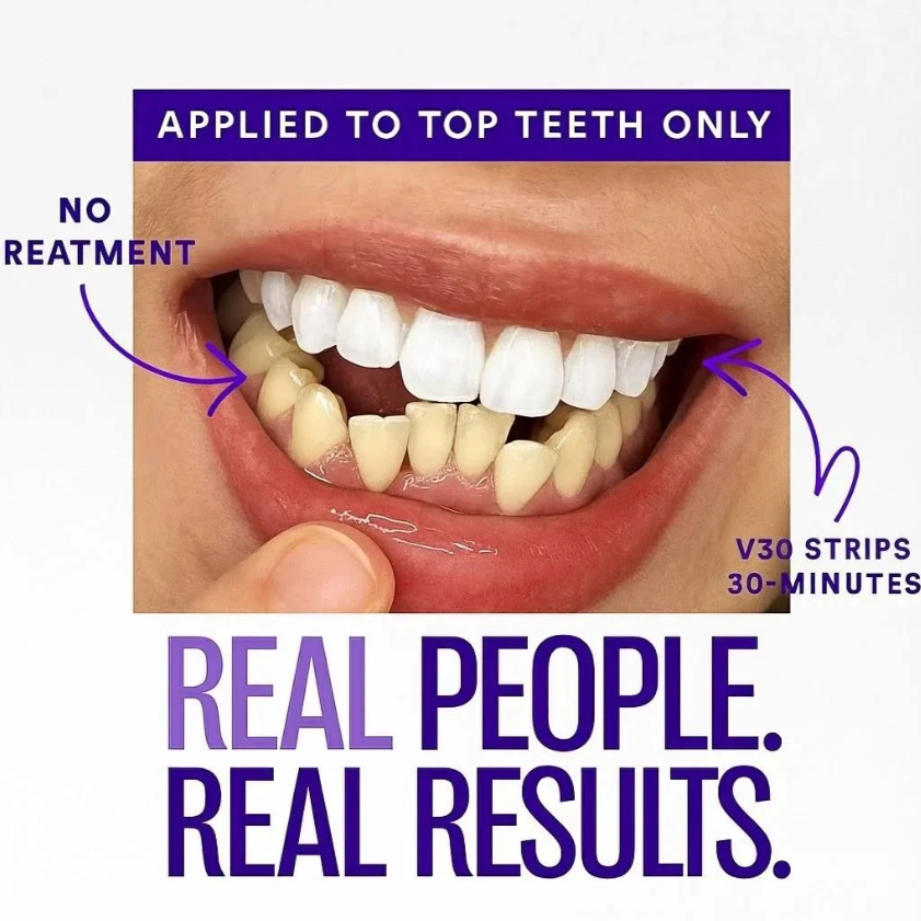 🔥 Limited-Time Deal: Purple Teeth Whitening Strips