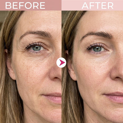 3-in-1 Eye Rejuvenation System – Red Light, Microcurrent & Exosome Eye Cream