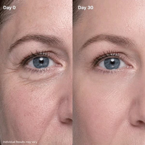 3-in-1 Eye Rejuvenation System – Red Light, Microcurrent & Exosome Eye Cream