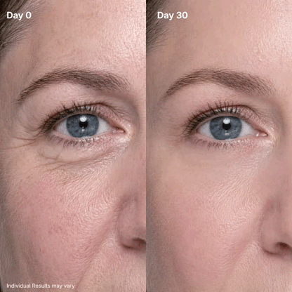 3-in-1 Eye Rejuvenation System – Red Light, Microcurrent & Exosome Eye Cream